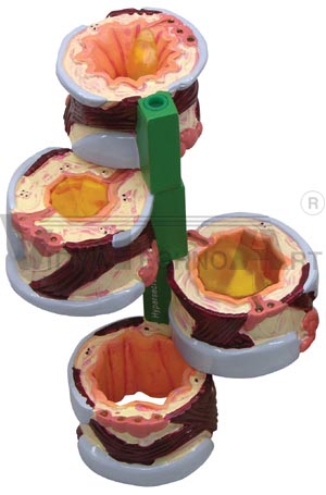 4-pc Bronchus Model